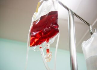 Wlewy witaminowe na odporność w Krakowie: kiedy warto rozważyć kroplówkę dożylną Worek z kroplówką podłączony do wenflonu w szpitalnym otoczeniu
